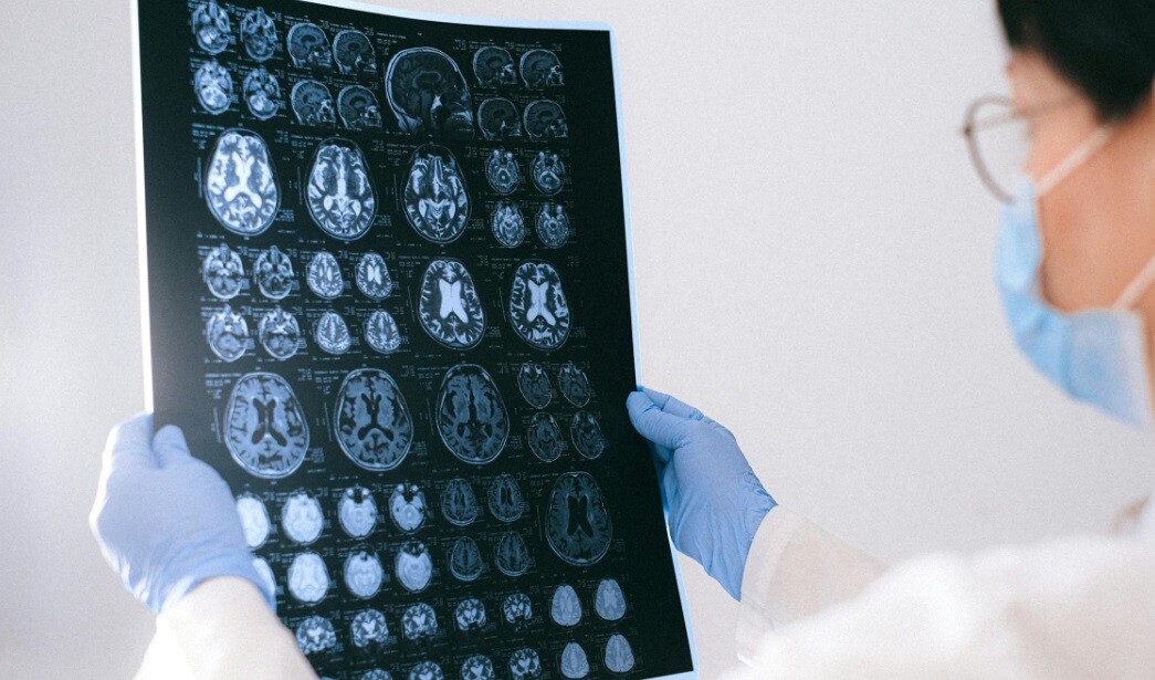 a doctor analyzing the CT scan for brain stroke